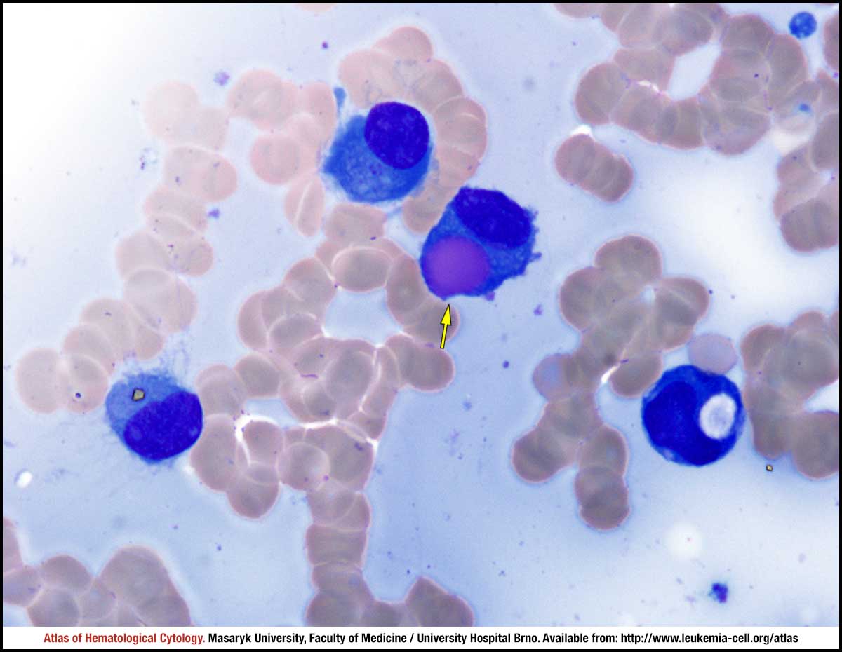 Steam cell plasma фото 59