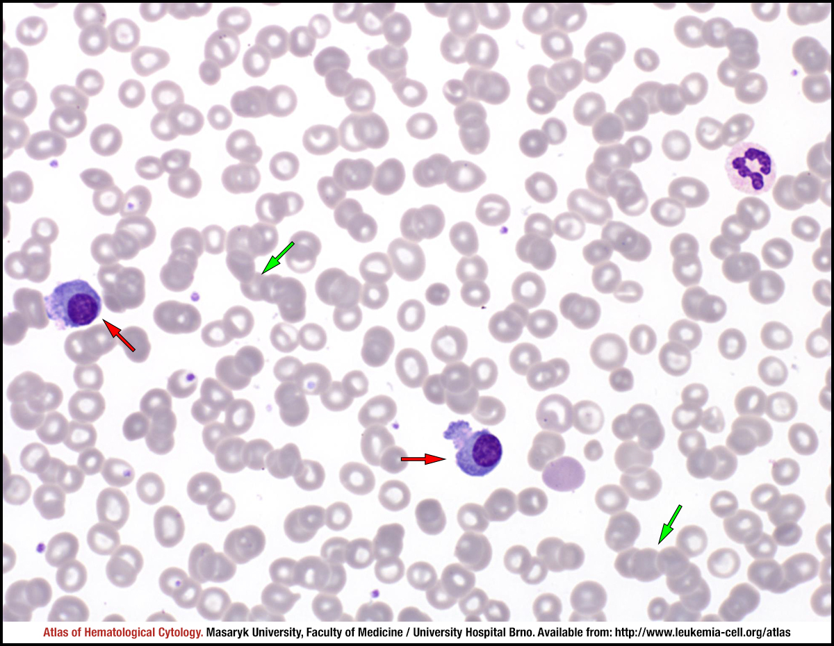 Steam cell plasma фото 119