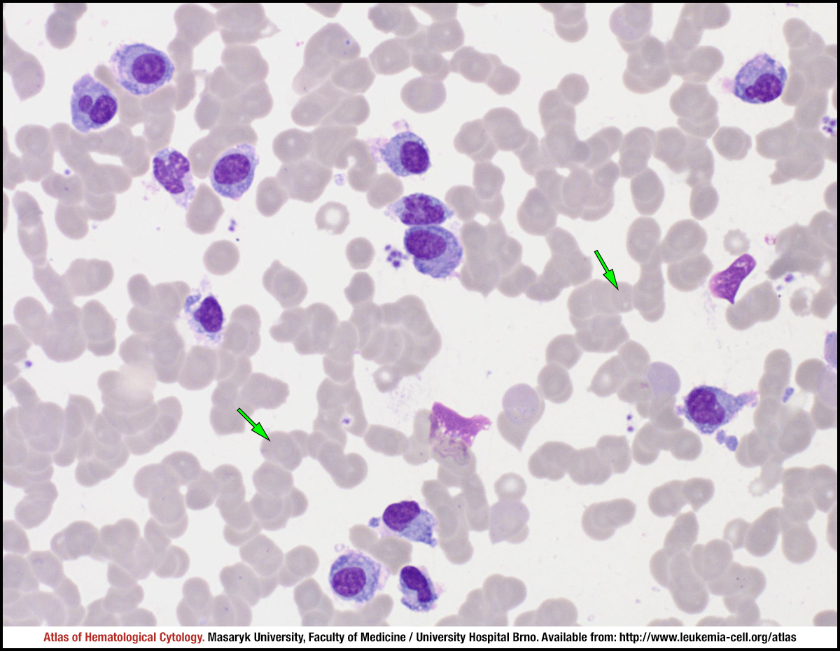 Steam cell plasma фото 84