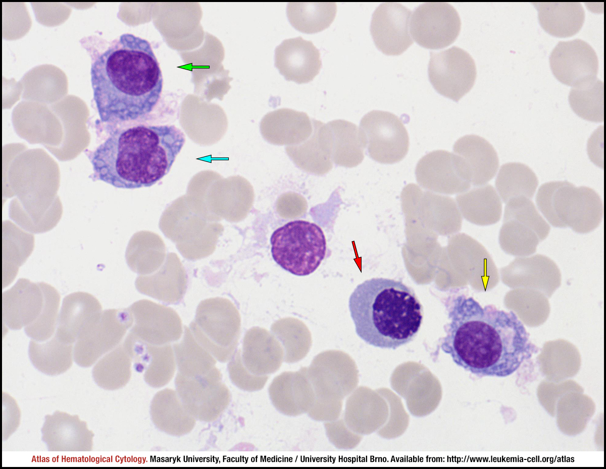 Steam cell plasma фото 3