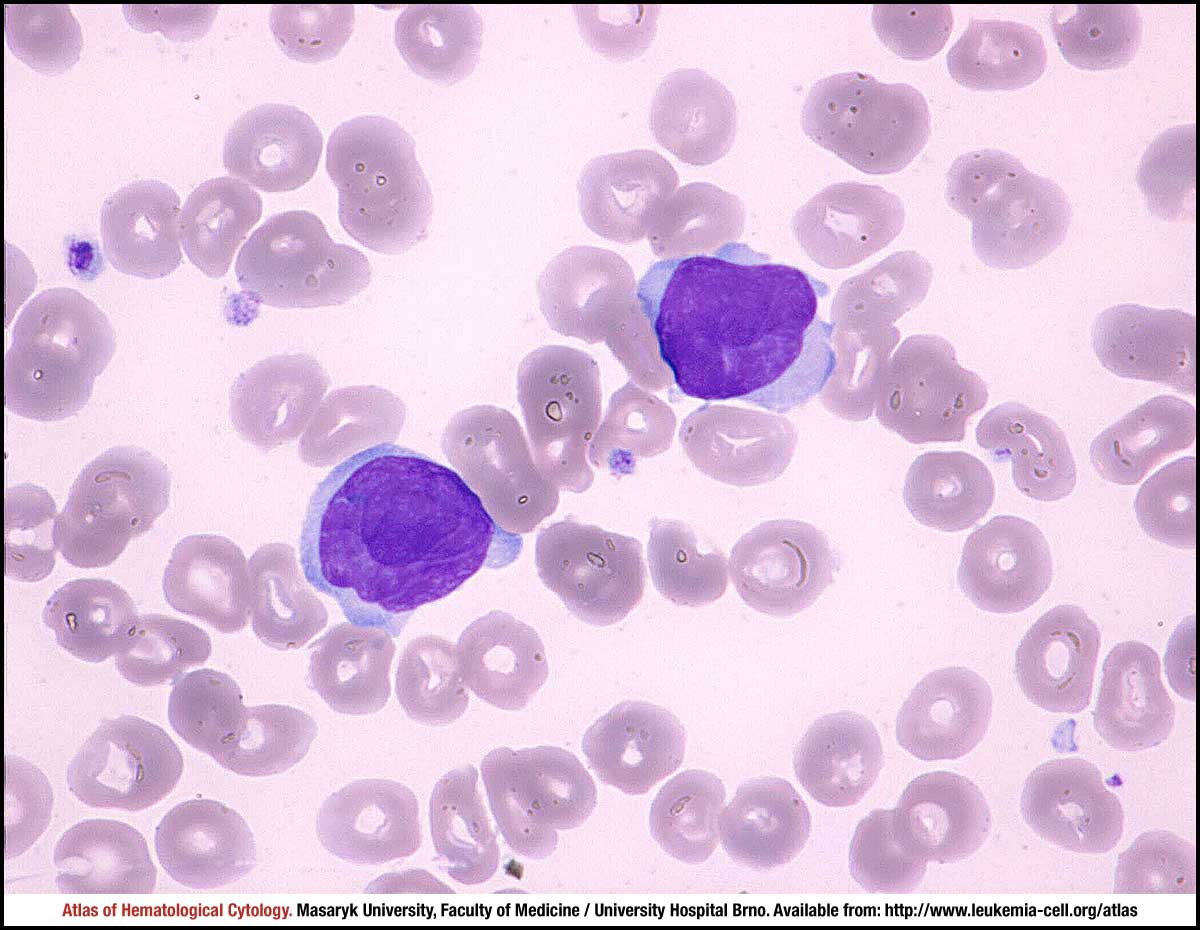 cerebriform nuclei