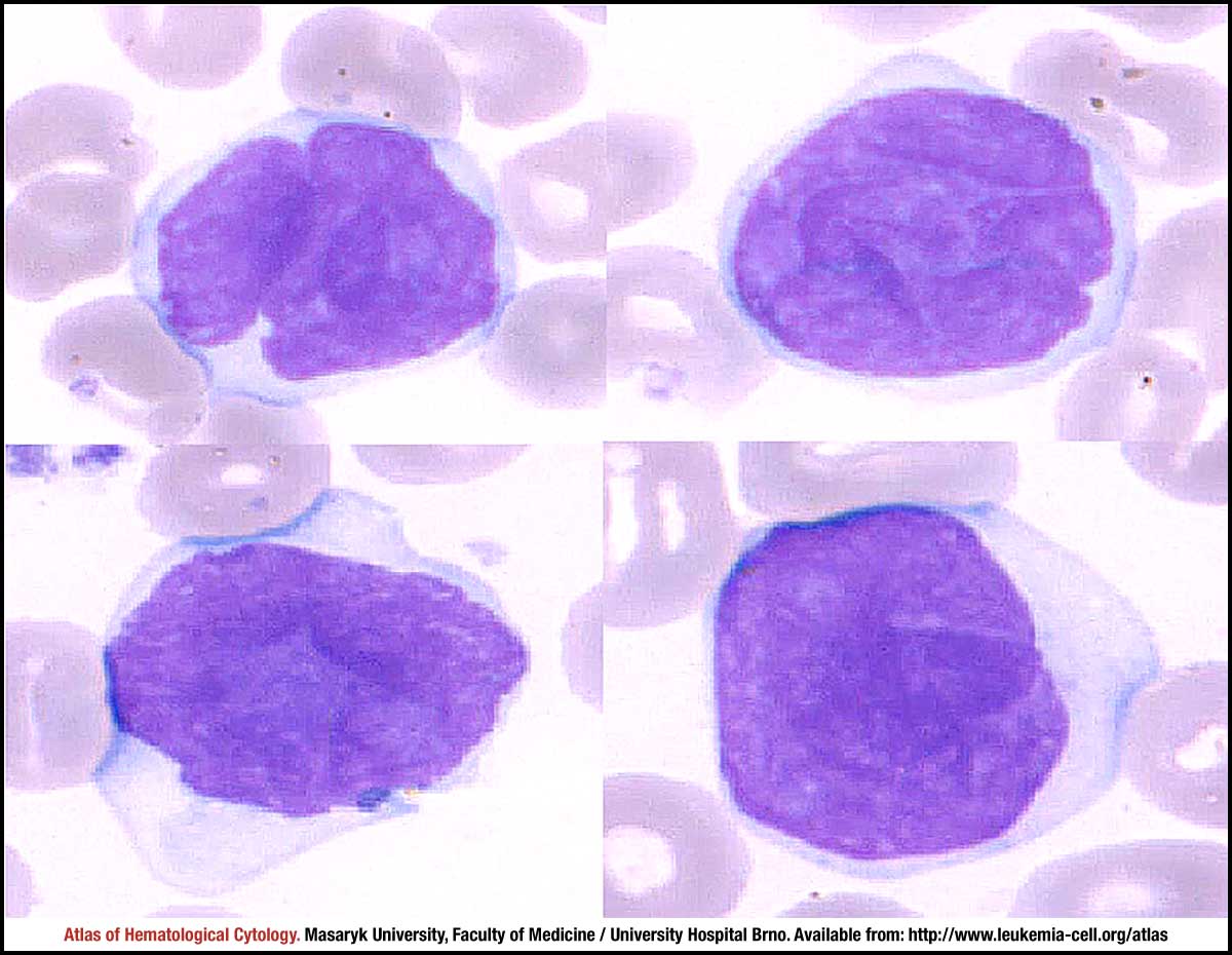 cerebriform nuclei