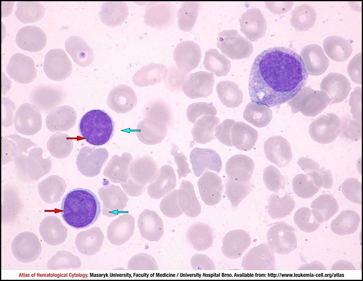 cerebriform nuclei