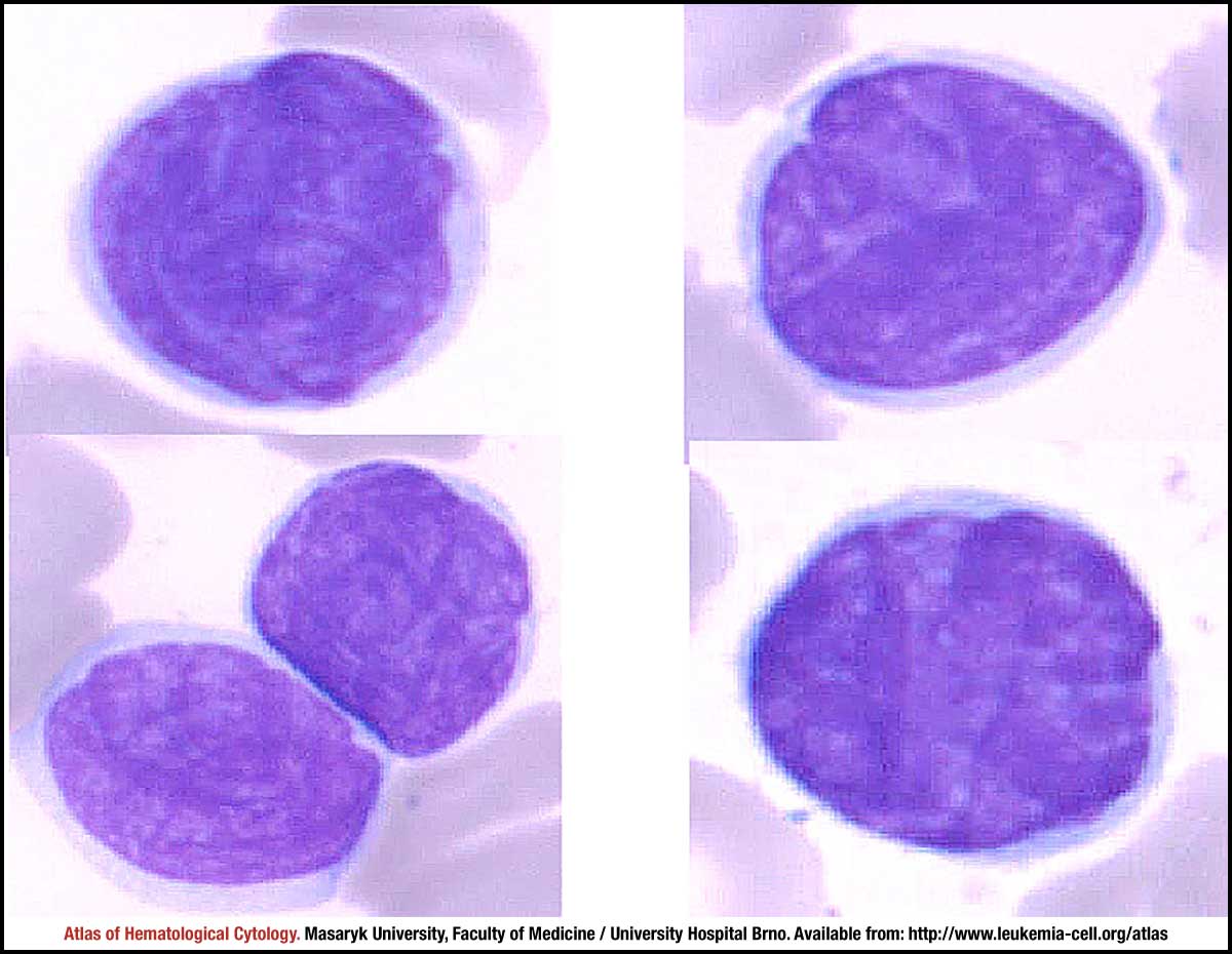 cerebriform nuclei