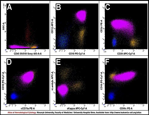 BM flow cytometry