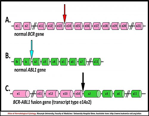 Schematic representation of ''BCR'', ''ABL1'' and ''BCR-ABL1'' genes