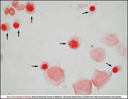 BM iron stain (1000×)