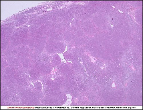 Lymph node HE (20×)