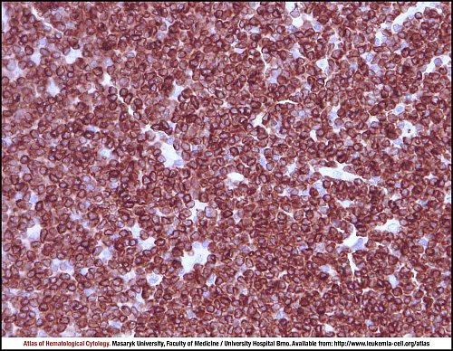 Lymph node IHC (400×)