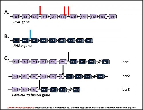 Schematic representation of ''PML'', ''RARA'' and ''PML-RARA'' genes