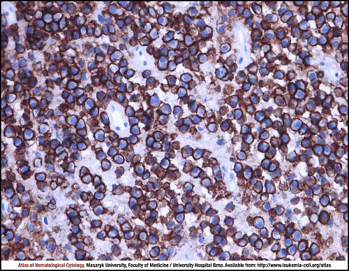 BM IHC (400×)