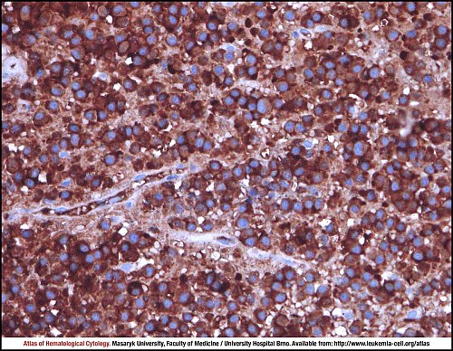 BM IHC (400×)