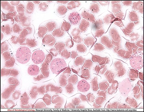 BM ANAE with NaF (1000×)