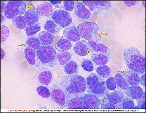 Lymph node MGG (1000×)