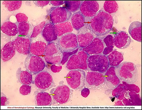 Lymph node MGG (1000×)