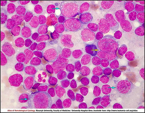 Lymph node MGG (1000×)