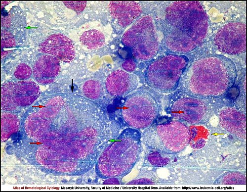 Lymph node MGG (1000×)