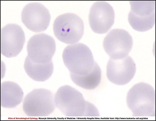 PB Giemsa stain (1000×)