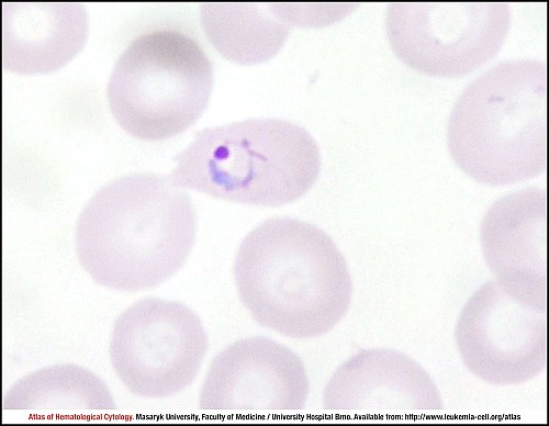 PB Giemsa stain (1000×)