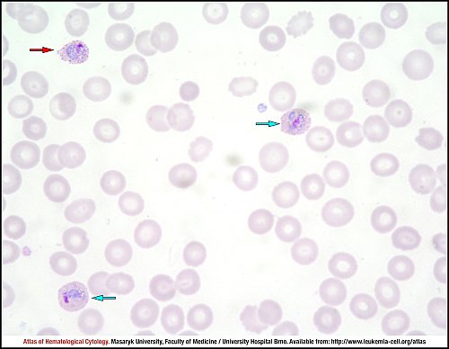 PB Giemsa stain (1000×)