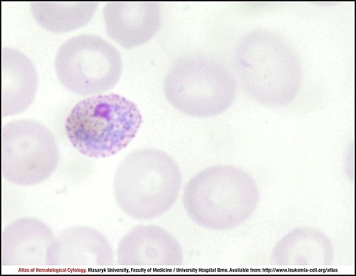PB Giemsa stain (1000×)