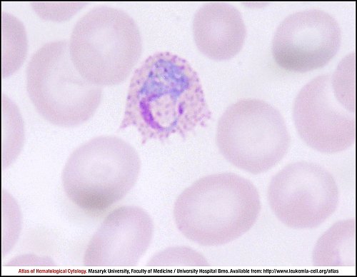 PB Giemsa stain (1000×)