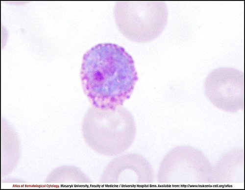 PB Giemsa stain (1000×)