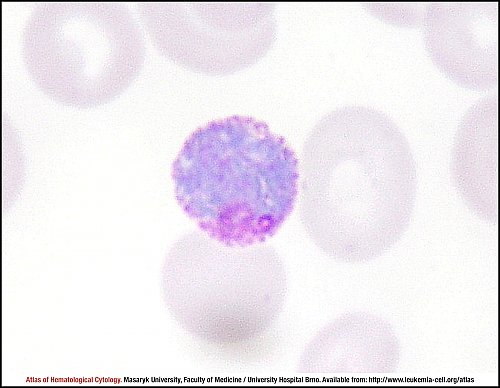 PB Giemsa stain (1000×)
