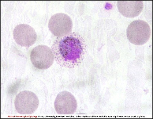 PB Giemsa stain (1000×)