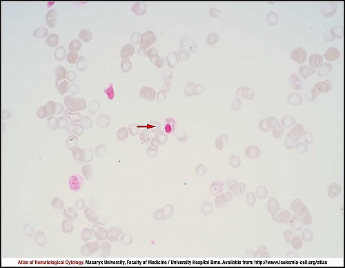 BM iron stain (1000×)