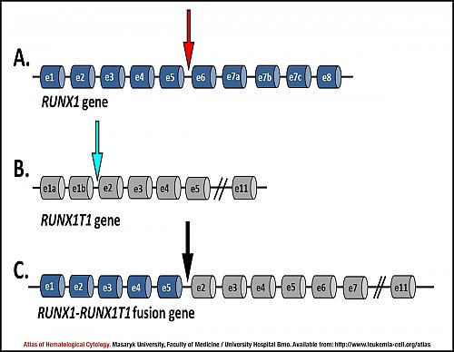 Schematic representation of ''RUNX1'', ''RUNXT1'' and ''RUNX1-RUNX1T1'' genes