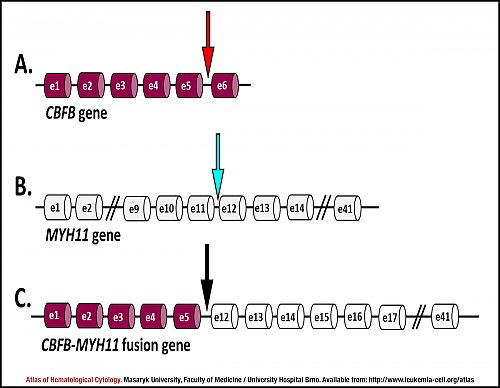 Schematic representation of ''CBFB'', ''MYH11'' and ''CBFB-MYH11'' (type A) genes
