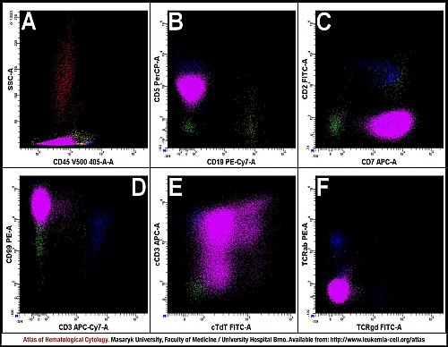 BM flow cytometry