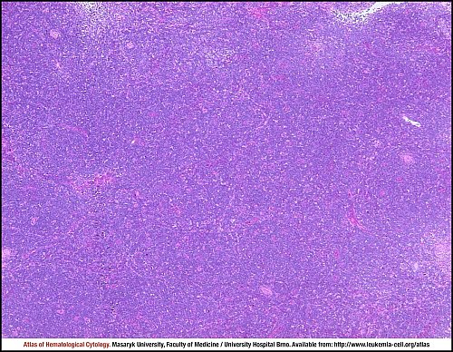 Lymph node HE (20×)