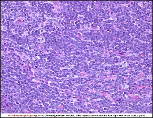 Lymph node HE (400×)