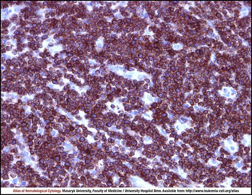 Lymph node IHC (400×)