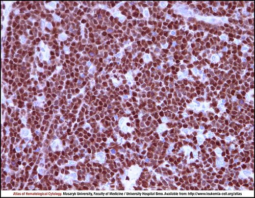 Lymph node IHC (400×)